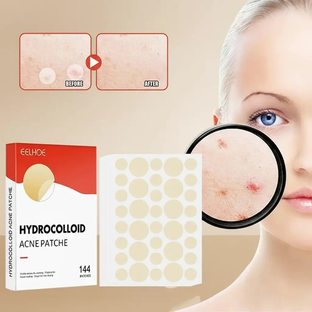 Patchs anti-acné invisibles hydrocolloïde